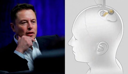En 6 meses se implantará primer chip en cerebro humano: Musk