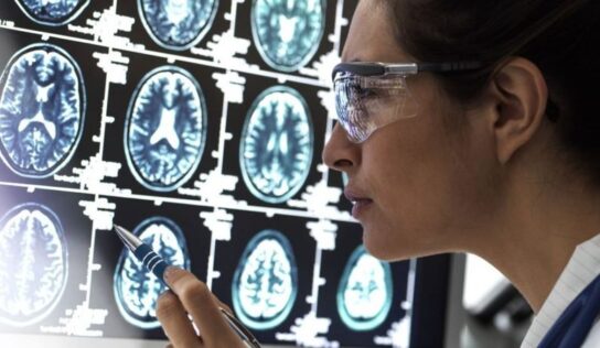 Donanemab, el nuevo medicamento que supone un «punto de inflexión» en el tratamiento del alzhéimer, según un estudio internacional